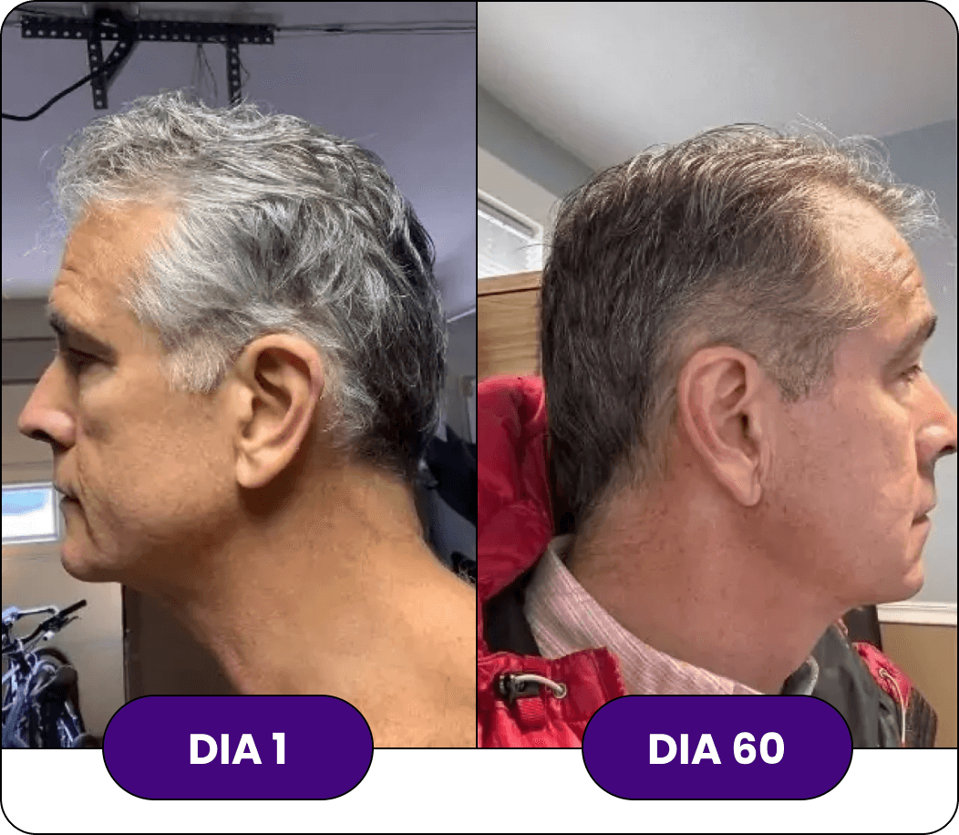 ANTES-E-DEPOIS02.png