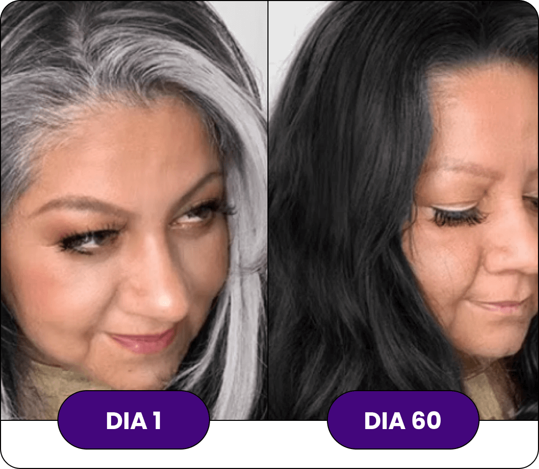 ANTES-E-DEPOIS04.png